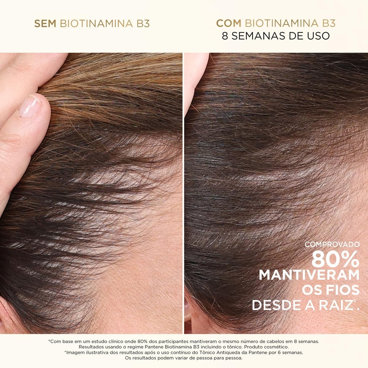 Tônico Capilar PANTENE 52ml Biotinamina B3 – Tratamento para o Couro Cabeludo, Fortalecimento, Nutrição e Cuidado Capilar